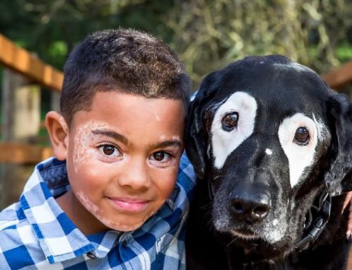 El niño con vitíligo que ha conocido a un perro con su mismo problema